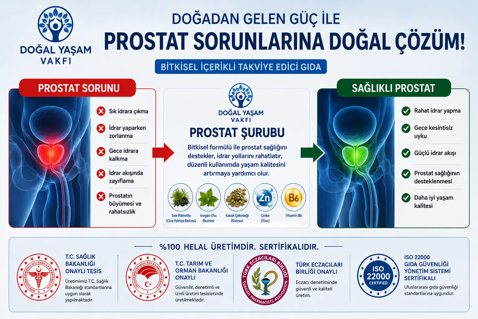Prostat Şurubu Bölüm 2